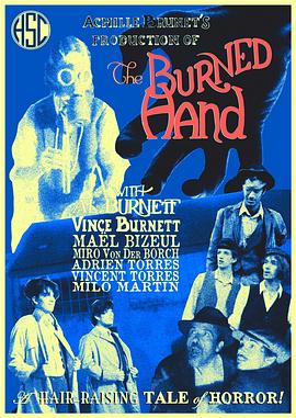 The Burned Hand